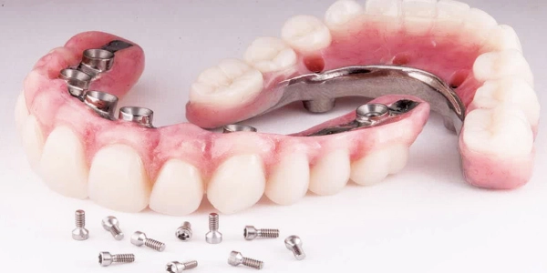 Full Mouth Reconstruction | Carve Dental Studio | Gota | Ahmedabad | Gujarat