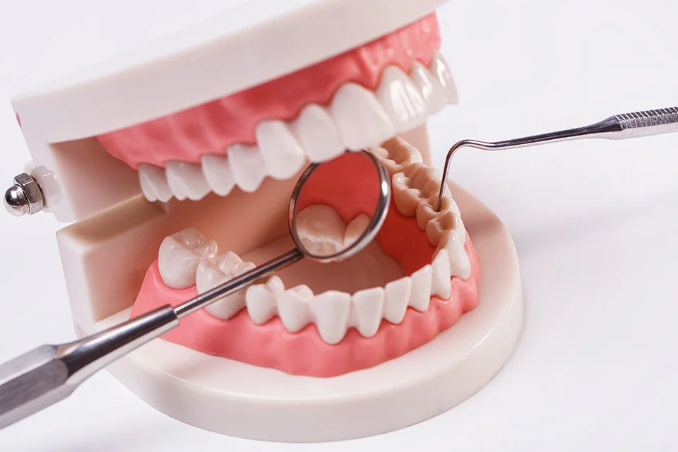 Full Mouth Reconstruction |Best dentist care in Ahmedabad| Carve Dental Studio | Gota | Ahmedabad | Gujarat